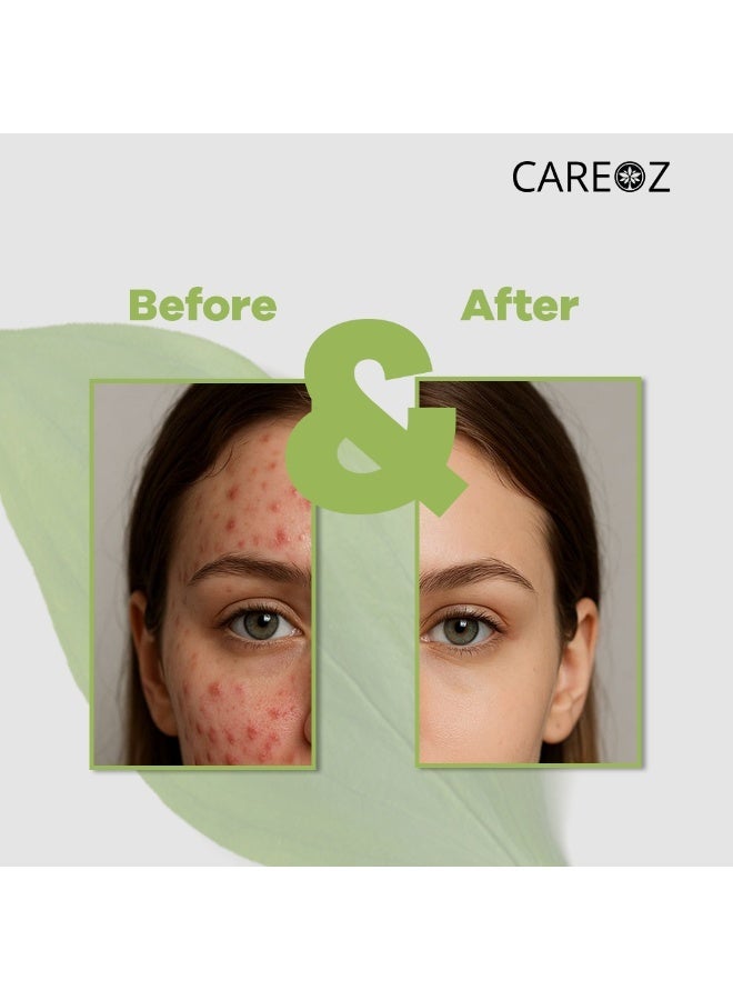 CAREOZ French Green Clay + Multani Mitti Detox & Glow Mask Duo - Image 5